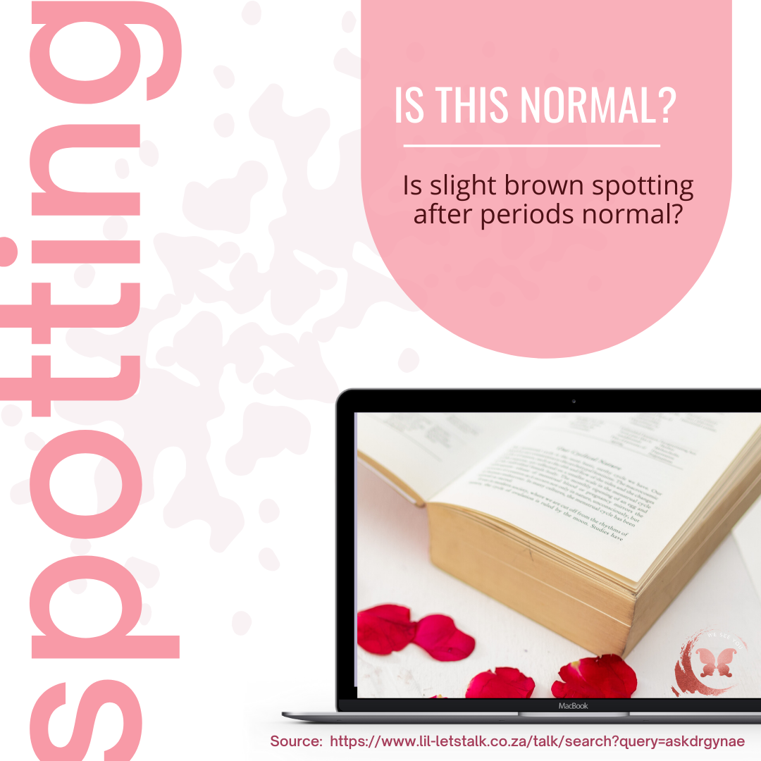 Is slight brown spotting after periods normal?